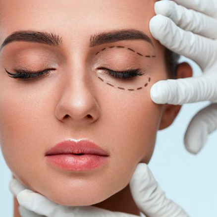 Blefaroplastia