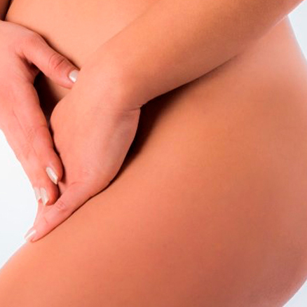 ninfoplastia