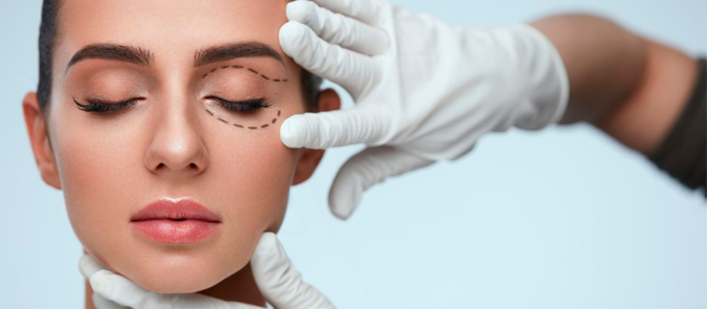 Blefaroplastia