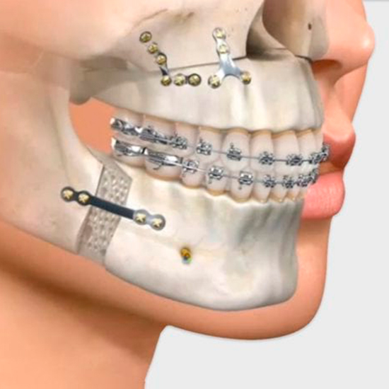 buco-maxilo-facial.jpg