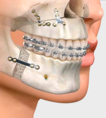 Bucomaxilofacial
