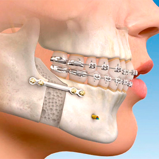 buco-maxilo-facial.jpg
