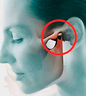Disfunção Temporomandibular