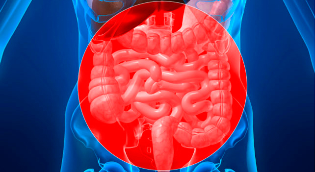 Doenças inflamatórias intestinais - DII