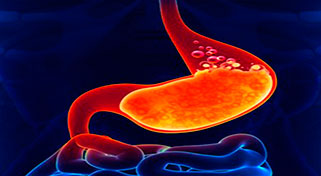 Dispepsia